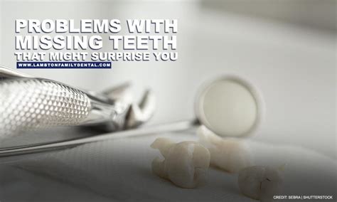 Problems With Missing Teeth That Might Surprise You | Lambton Family Dental