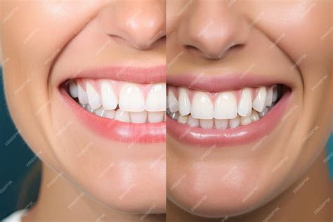 Premium AI Image | Before and after photo of teeth being cleaned and ...