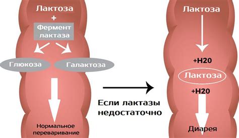 Лактоза – свойства, польза и вред, непереносимость, её симптомы и ...