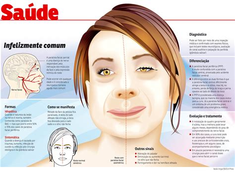 Paralisia Facial E Perigoso - Paralisia Facial E Perigoso - RETOEDU