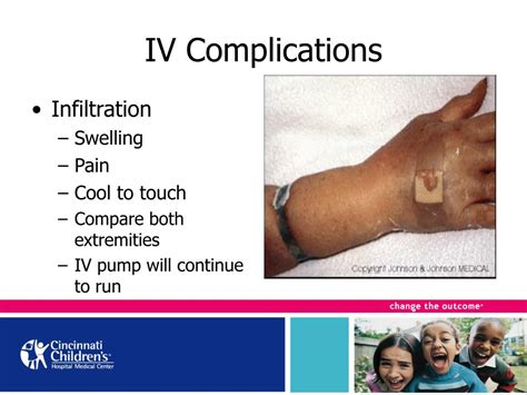 peripheral ivs powerpoint    id