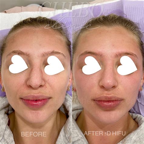 InfluencerGoneWild's Before & After: The Results Will SHOCK You! Image 4