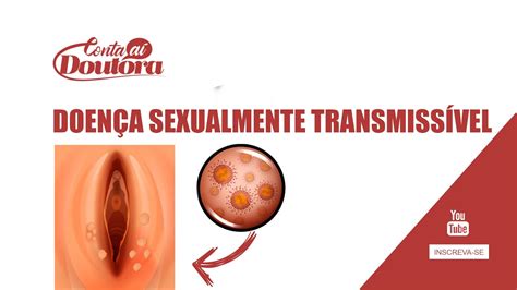 Como Saber Se Estou Com Alguma Doença Sexualmente Transmissível - DOENÇA SEXUALMENTE TRANSMISSÍVEL (DST) - Sintomas, Diagnóstico e ...