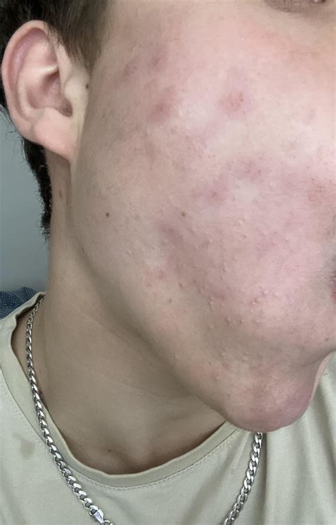 rid   rskincareaddicts