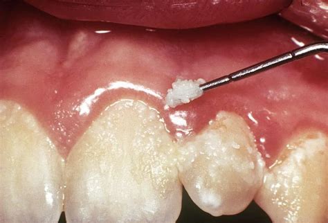 mouth rinses good   twinkle family dentalcare