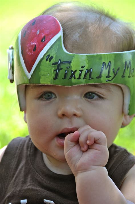 Cranial Helmets For Babies - BABBIES CIP