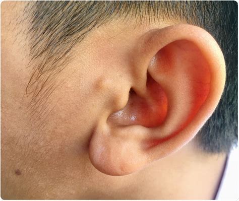 attached ear lobes