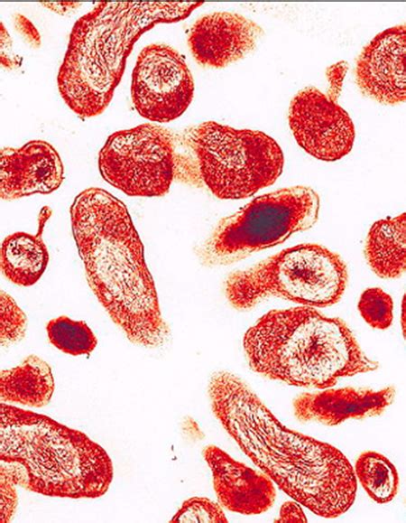 Coxiella burnetii, a complex diagnosis | Vircell