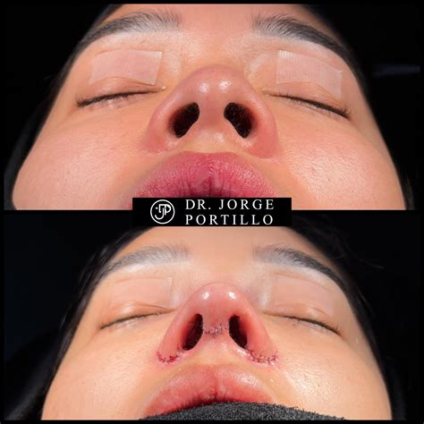 Dr. Jorge Portillo / Cirugía Facial y Otorrinolaringología. | Mexico City