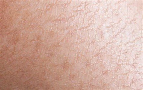 Skin Conditions - Face 2 Face Mallorca
