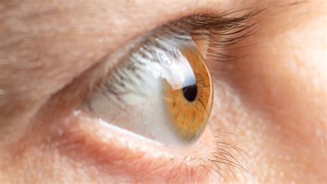 understanding thyroid eye disease sightmd