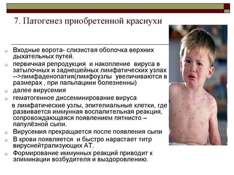 Вирус краснухи - online presentation