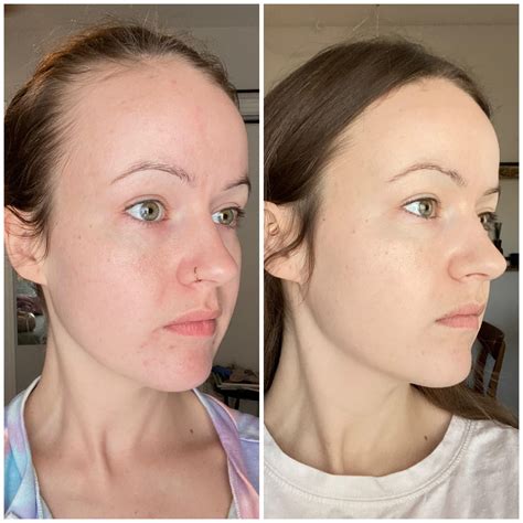 how to apply tretinoin cream 7