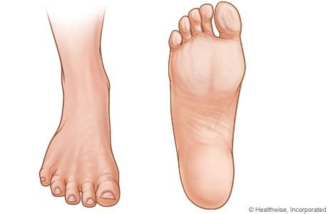 Step Up Your Foot Care Game with Our Guide to Healthy Feet