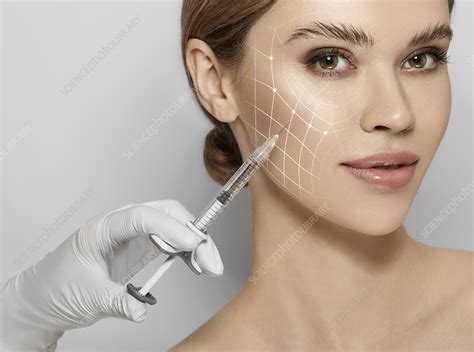 cosmetic injection stock image  science photo library
