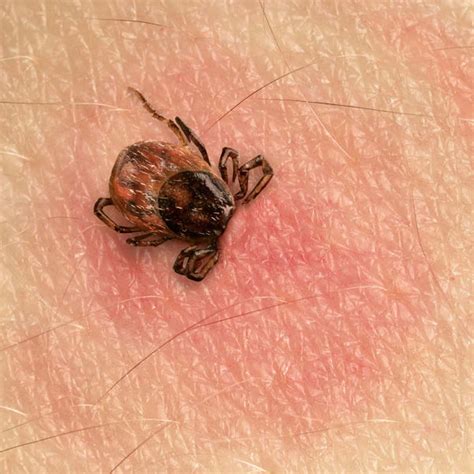The most dangerous Lyme bacteria are transferred by thrushes – PelhamPlus