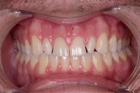 Maximizing Dental Care with Efficient Esthetics - DEO Magazine