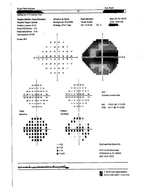 Assessing visual fields — Vision Rehab OT