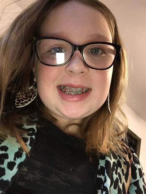 Yuleema Imaginee Without Braces