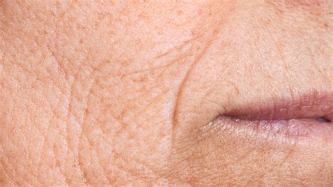 Why Do Wrinkles Form? – Triple Solution Skincare