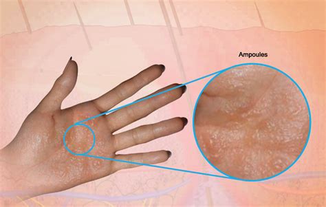 Health Condition : Symptoms, Causes, Treatment and More