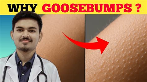Why Do We Get Goosebumps? (The Surprising Science Explained!) - YouTube