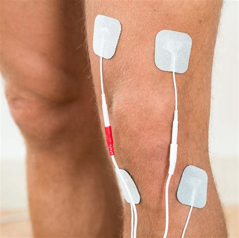 Electrical Stimulation Physical Therapy | Lonoke Physical Therapy