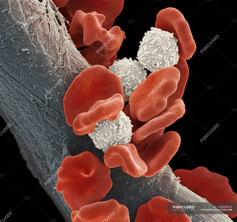 Leukaemia blood cells — scanning electron micrograph, White Blood Cell