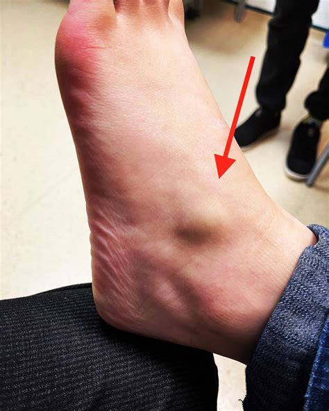 An unusual presentation... - Manchester Foot & Ankle Clinic | Facebook