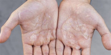 kopi   menghaluskan telapak tangan kasar  kering