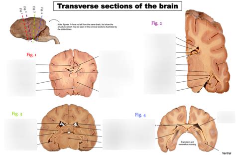 transverse sections   brain diagram quizlet