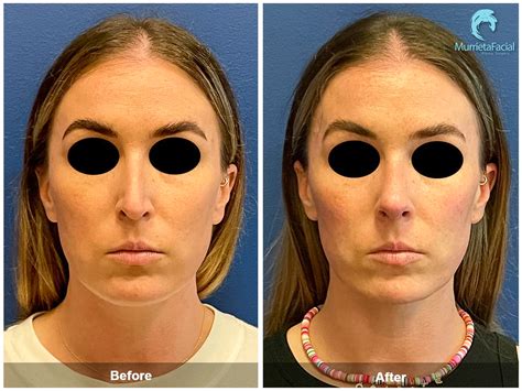 Murrieta Patch: Before & After Photos Will Astound You! Image 5