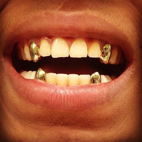 Can You Take Out Permanent Gold Teeth - Vanessa Fernandez Hochzeitstorte