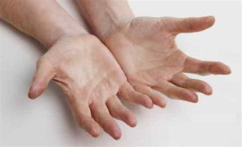 examples  human laterality listverse