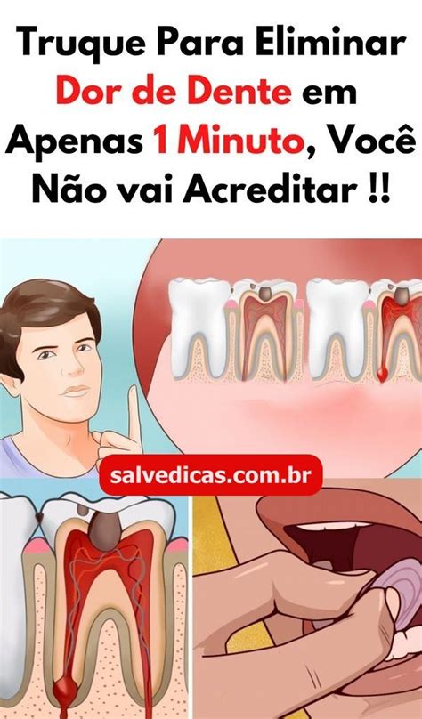O Que Fazer Para Amenizar Dor De Dente - Dor de dente – Artofit