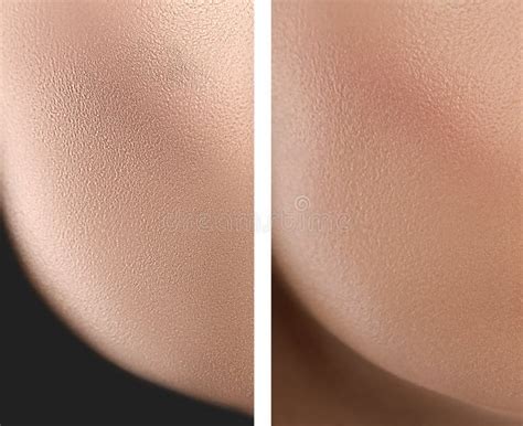 collage    dry  moisturized skin texture stock photo