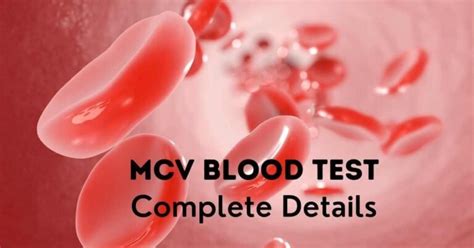 MCV Blood Test: High,Low,Causes,Symptoms,Treatments – DoctorOnHealth