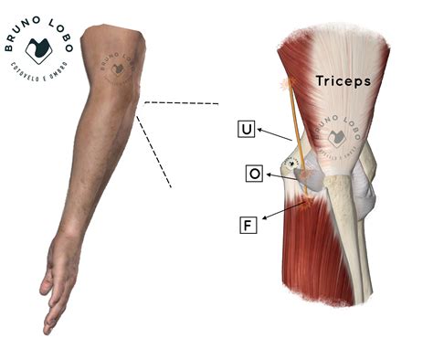 NEUROPATIAS COMPRESSIVAS NO COTOVELO – Bruno Lobo