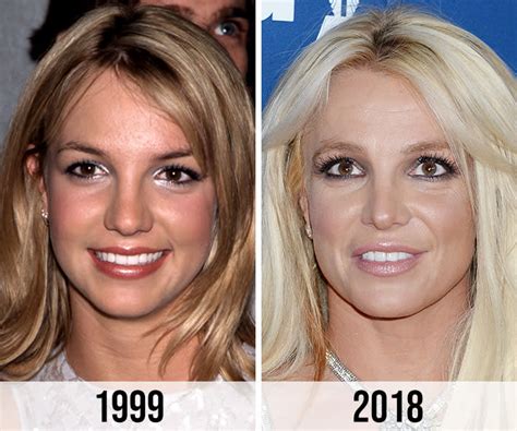 Britney Spears' Fans Criticize Her Alleged Nose Job On Instagram