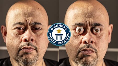 Largest Head In The World Guinness World Records