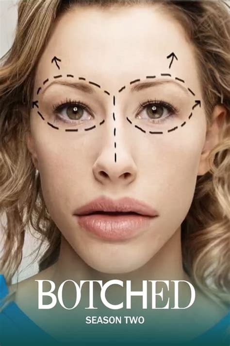 botched season    australia comparetv