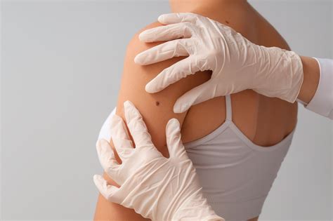 Melanoma research: targeted drug duo reactivates immune response - Drug