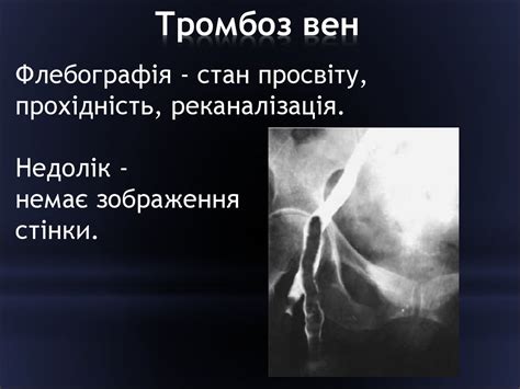 Променева діагностика невідкладних станів - презентация онлайн