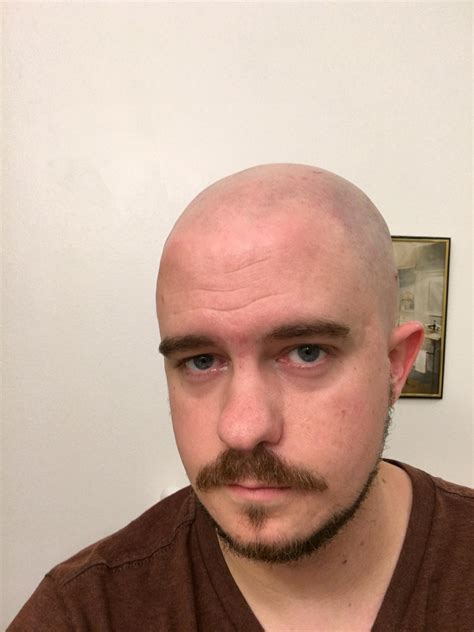 reddit zits 8