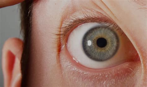 Sleeping With Eyes Open: Treatment, Causes, And Safety, 43% OFF