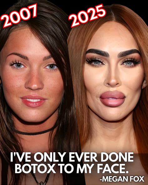 Spilling - Megan Fox on plastic surgery…😳 | Facebook