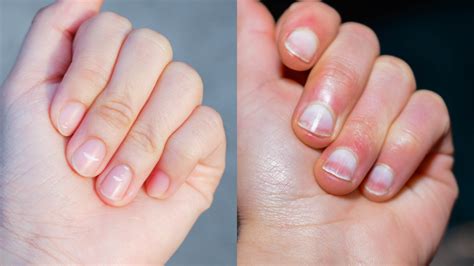 4 Possible Causes of Nail Issues | Woman's World