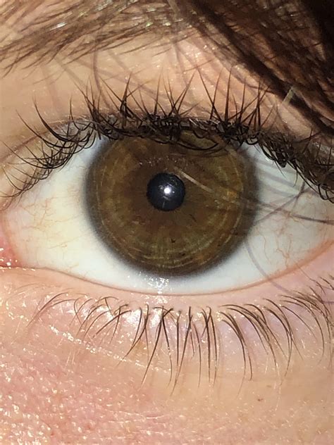 brown or amber? do i have central heterochromia? : r/eyes