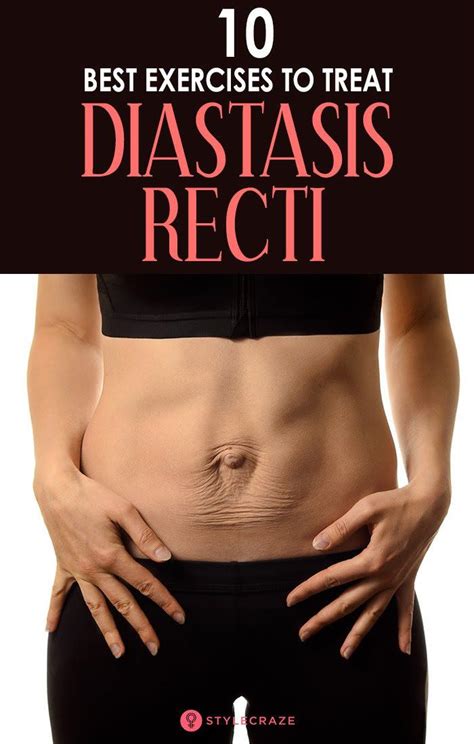 10 exercises for diastasis recti that strengthen your core – Artofit