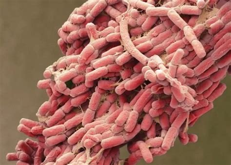 mengenal bakteri  coli  perannya akurat